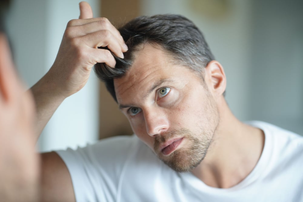 PRFM for Hair Restoration in NYC 1 1780692996 001908c0da0f48218985319fefde18d9 1