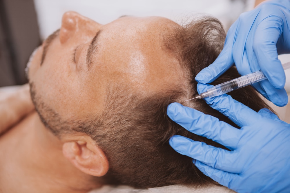 Chemical Peels in NYC 1 1780693013 a96fa5359deb43ac9c16b2957ecfcdd8 1